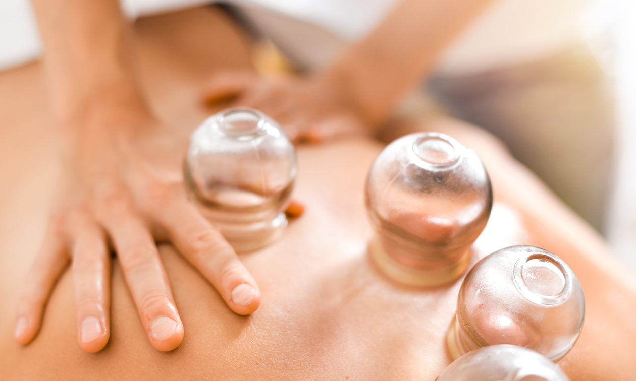 Acupunctuur Vernimmen