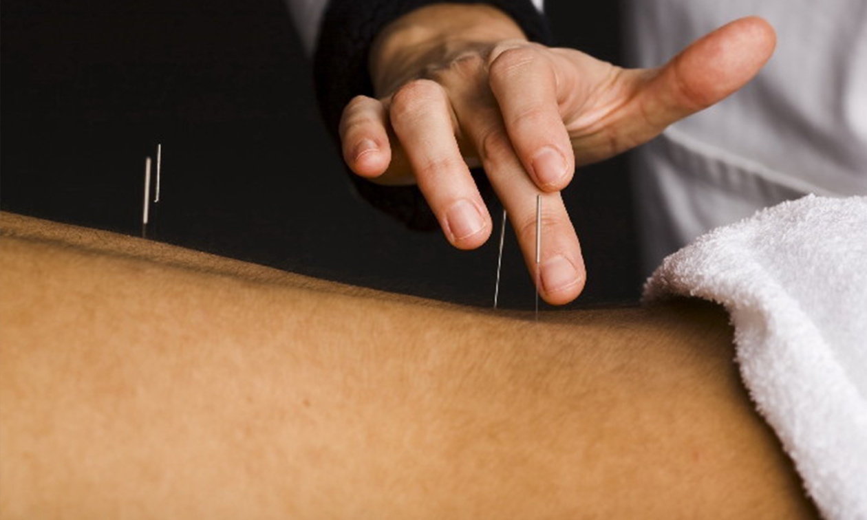 Acupunctuur Vernimmen