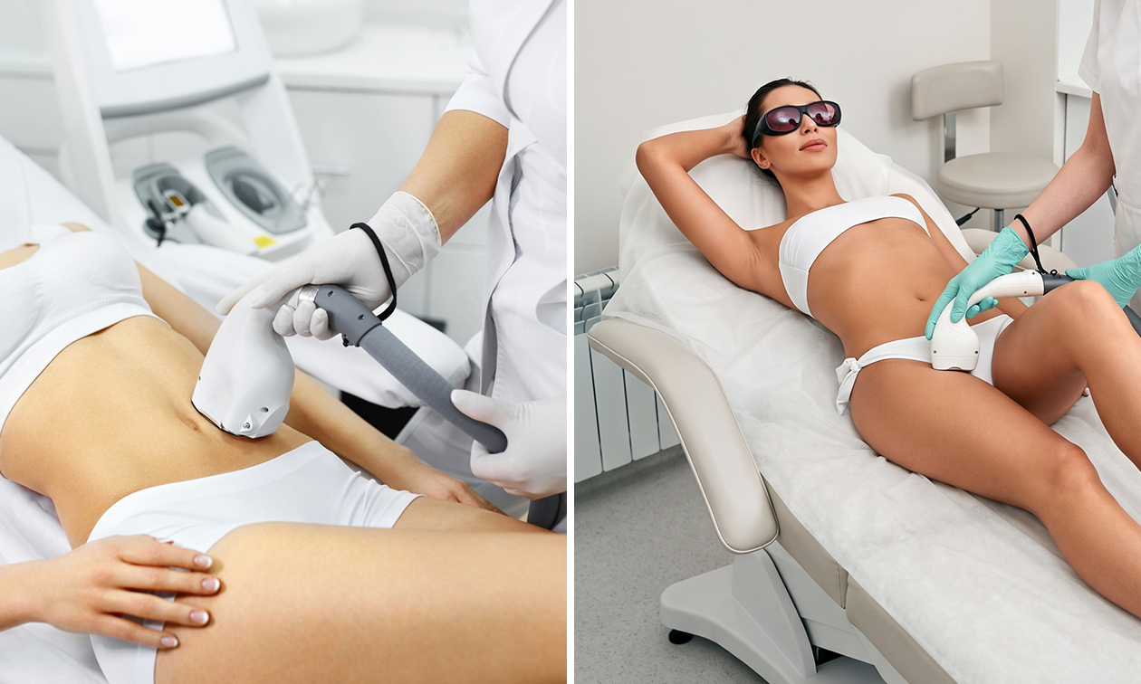 NUDE - Epilation Laser