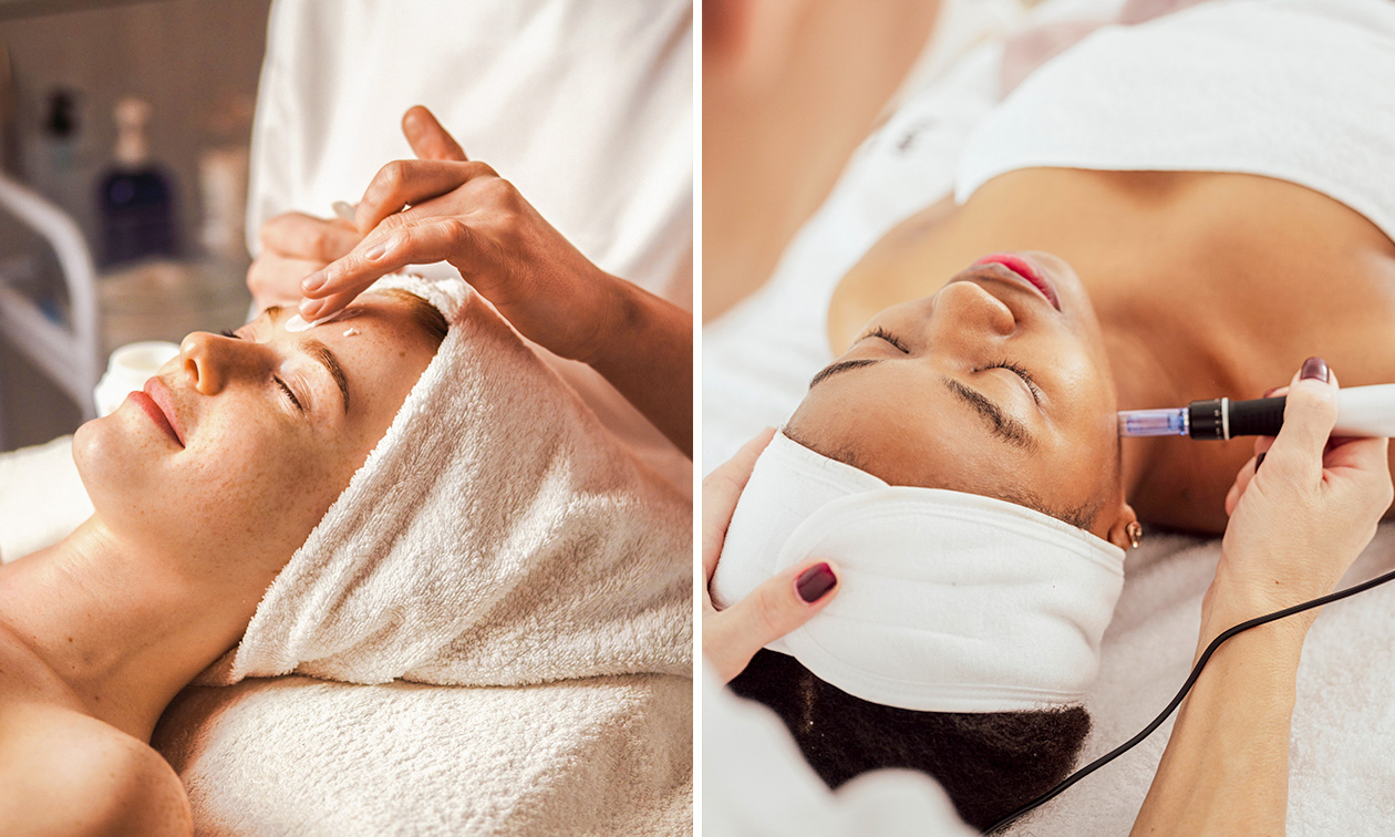 Gezichtsbehandeling of microneedling (60 min)
