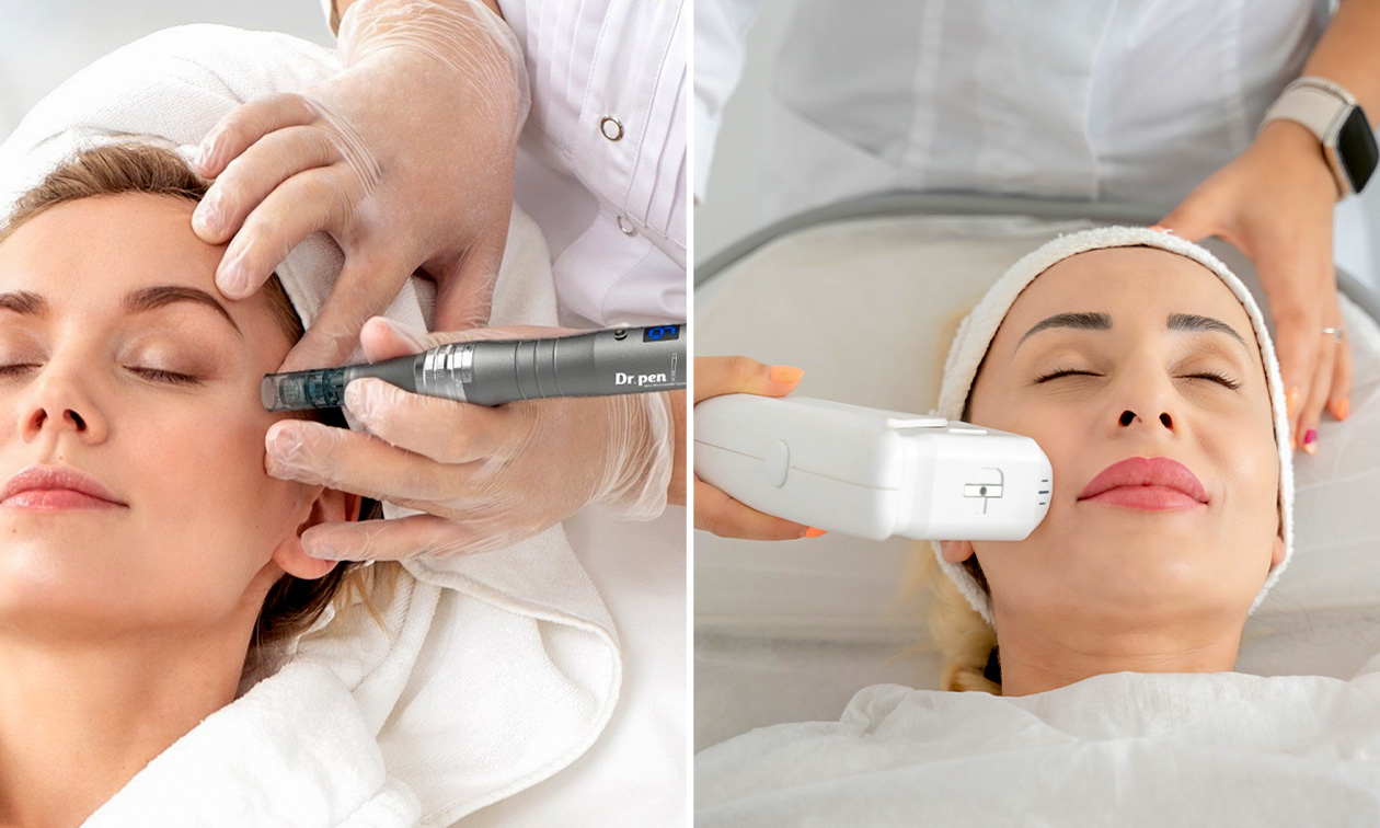1 of 3 microneedling- of HIFU-behandeling(en) voor een zone naar keuze