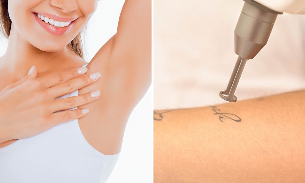 6 laser-ontharingsbehandelingen voor zone naar keuze of tattoo verwijderen